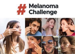 El Cáncer de piel se puede prevenir