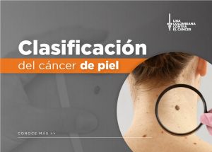 Cáncer de piel y su clasificación